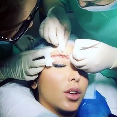 قوّي قلبك... وشاهدي جراحة زرع حواجب جويل ماردينيان