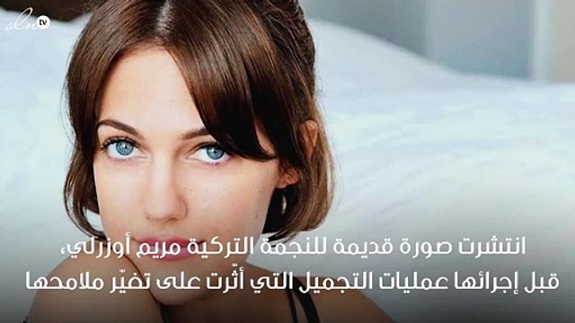 جمهور مريم أوزرلي يقارن صورتها قبل وبعد عمليات التجميل.. الفرق صادم!