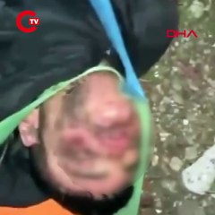Kayıp olarak aranıyordu... Dağ yolunda darbedilmiş halde bulundu!