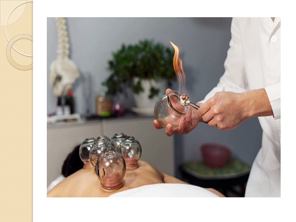 Physiotherapy and acupuncture: An approach to various issues