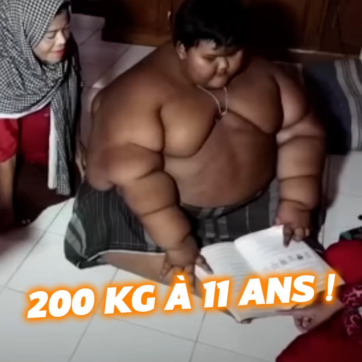192 KILOS À 11 ANS : L'enfant le plus gros du monde