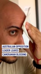 Australian opposition leader leaves cameraman bleeding