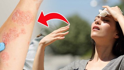 Heatstroke Precautions: हीटस्ट्रोक से कैसे बचें,जानें बचाव के आसान उपाय | Boldsky