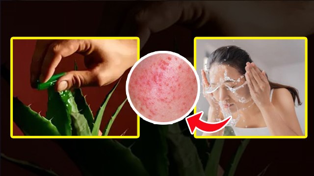Face Wash After Applying Aloe Vera: एलोवेरा लगाने के बाद चेहरा धोना चाहिए या नहीं,Benefits In Hindi