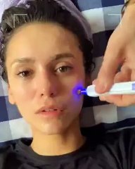 The Beauty Sandwich: علاج البشرة الجديد المفضّل لدى نجمات هوليوود!