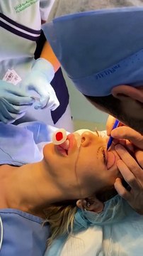 جويل مردينيان تخضع لعملية جراحية بوجهها