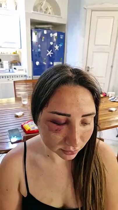 Gaia pestata a sangue dal suo ex Mi sono opposta altrimenti mi a