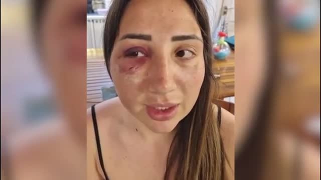 Gaia: «Io, picchiata dal mio ex e due amici: pensavo di non uscirne viva»