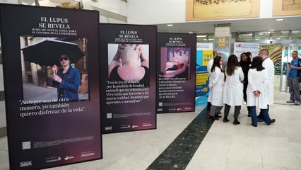 El Hospital Ramón y Cajal acoge una exposición sobre lupus para visibilizar la enfermedad
