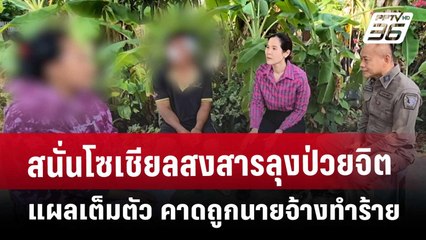 สนั่นโซเชียลสงสารลุงป่วยจิต แผลเต็มตัว คาดถูกนายจ้างทำร้าย | จับข่าวคุย | 8 เม.ย. 68