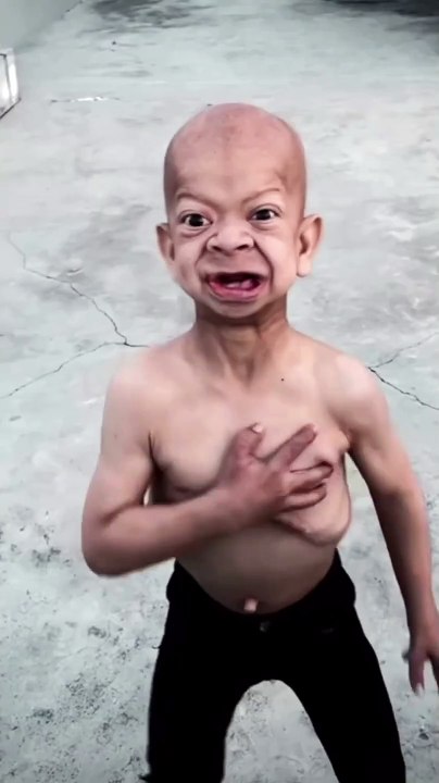 Frog🤣vs Man voice🤣😄#shorts#viral#funny