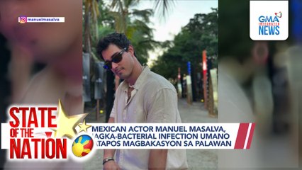 Manuel Masalva, nagka-bacterial infection; Caitlyn Stave, nahulog mula sa kabayo; Madonna x Elton John | SONA