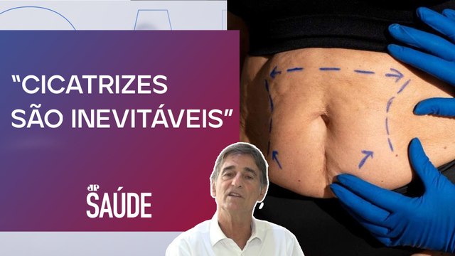 Cirurgião explica principais motivos para procura por cirurgia bariátrica | Dr. Juvenal