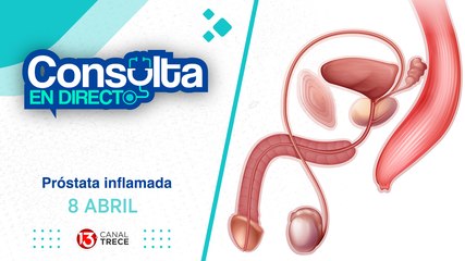08 Abril 2025 | Consulta en Directo