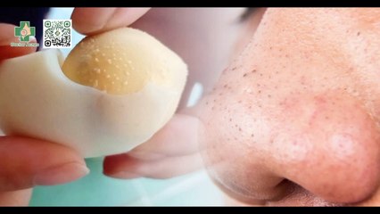 Lăn trứng gà trị mụn có thật sự hiệu quả như lời đồn?