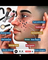 Causes and treatment of Blackheads
