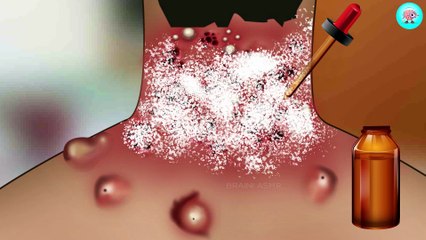 6. ASMR Removal Mggot Infected & Dog Ticks Severely Injured Animation