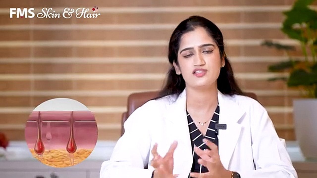 How Laser Hair Reduction Treatment Works | FMS Skin & Hair Clinics