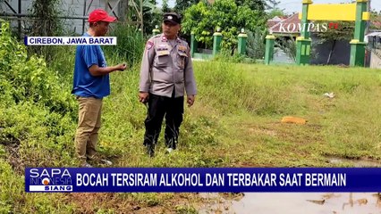 Bocah 12 Tahun di Cirebon Alami Luka Bakar Usai Tersambar Api dari Alkohol!