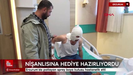 Erzurum'da patlayan sprey boya kutusu hastanelik etti
