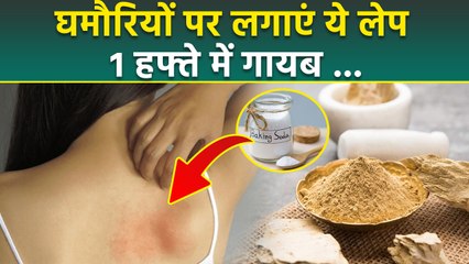 Heat Rashes Home Remedy: घमौरी कैसे ठीक करें ,Instant Relief Homemade Packs...