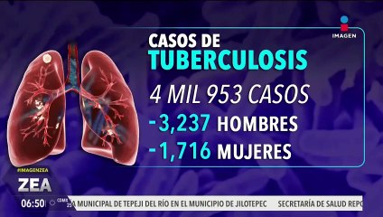 Tuberculosis en México: durante la última semana se confirmaron 412 nuevos contagios