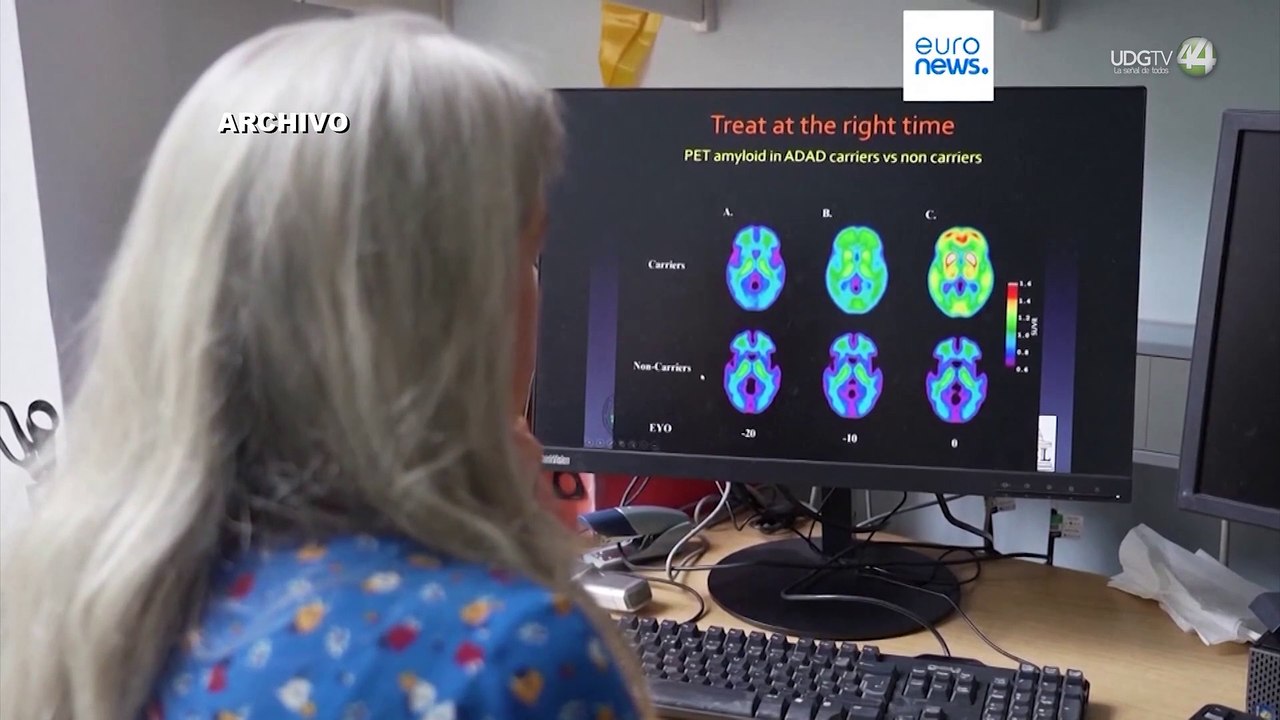 Vacuna contra herpes zóster podría reducir riesgo de demencia en adultos mayores