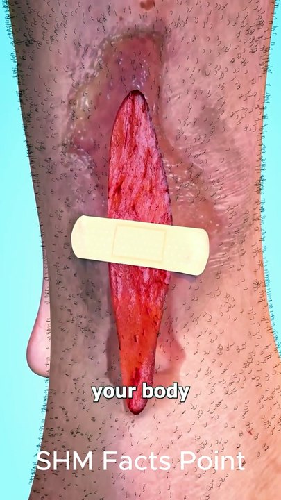 Small Band-Aid vs Huge Wound – Can It Handle the Damage  #shortsfeed #shorts #trending #short