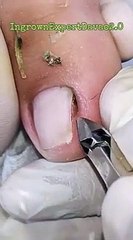 Panduan Pembersihan Kuku yang Tepat 🧼