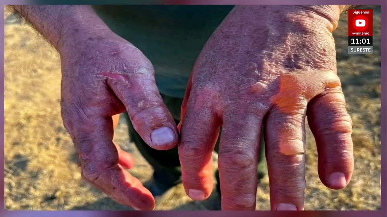 Incendio en Michoacán provocó lesiones a brigadistas de la Conafor