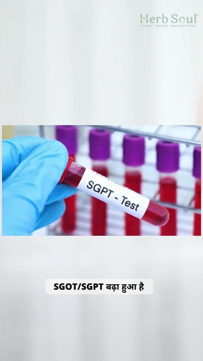 Liver Care Syrup | Ayurvedic Liver Tonic for Fatty Liver, Detox & Digestion