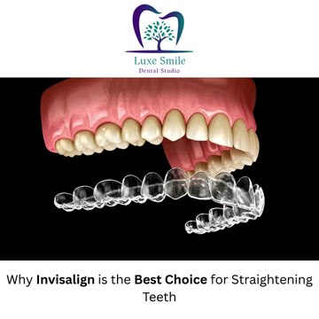 Why Invisalign is the Best Choice for Straightening Teeth