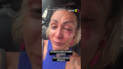 Ativista trans Iza Potter é agredida por homem no prédio em que mora em SP: ‘Estou com muito medo’