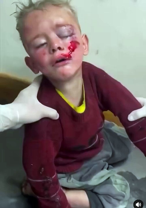 Child injured #