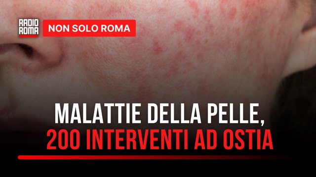 Malattie della pelle, al Grassi di Ostia oltre 200 interventi in 2 anni