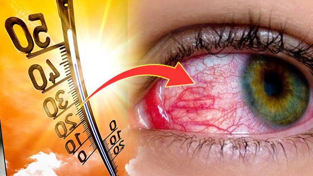 Heatwave Side Effects: हीटवेव से आंखों को हो सकता है गंभीर नुकसान,कैसे रखें खास ख्याल | Boldsky