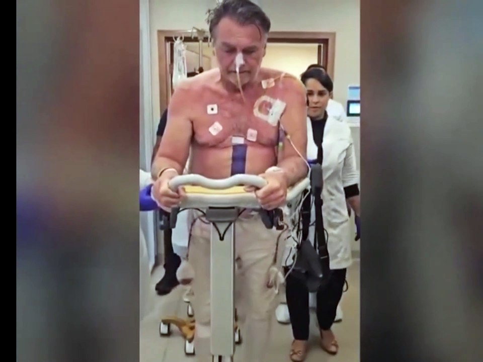Bolsonaro sigue "estable" tras la operación del intestino, según los médicos