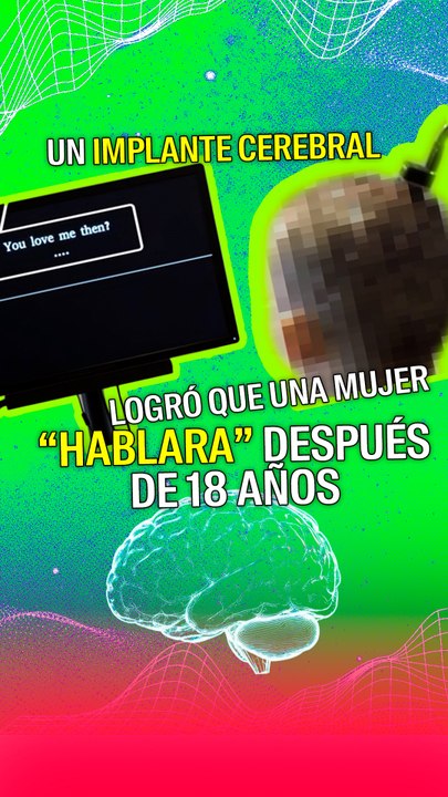 Un implante cerebral permitió que una mujer con tetraplejia "hablara" por primera vez en 18 años.