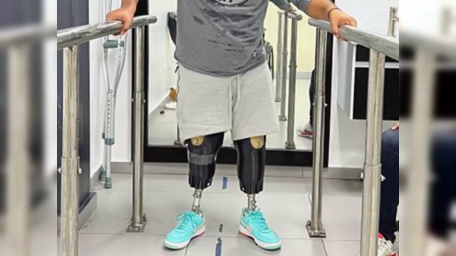 ITLA diseñará prótesis gratuitas a afectados de tragedia en Jet Set