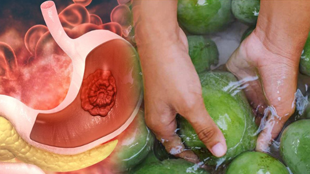 Mango Causes Gas: आम खाने से गैस बनती है क्या | Aam Khane Se Gas Banti Hai Kya | Boldsky