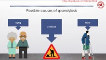 Possible causes of spondylosis