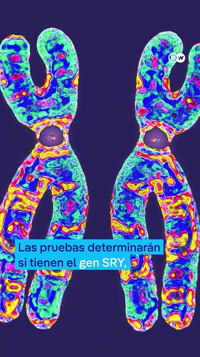 Pruebas de sexo en el deporte: ¿justas o degradantes?