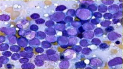 Urgent: Mechanical Engineer's Heartfelt Plea to Save His Life ❤️