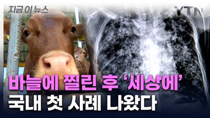 '폐결핵' 걸린 50대, 감염 경로 추적해 보니... [지금이뉴스]  / YTN