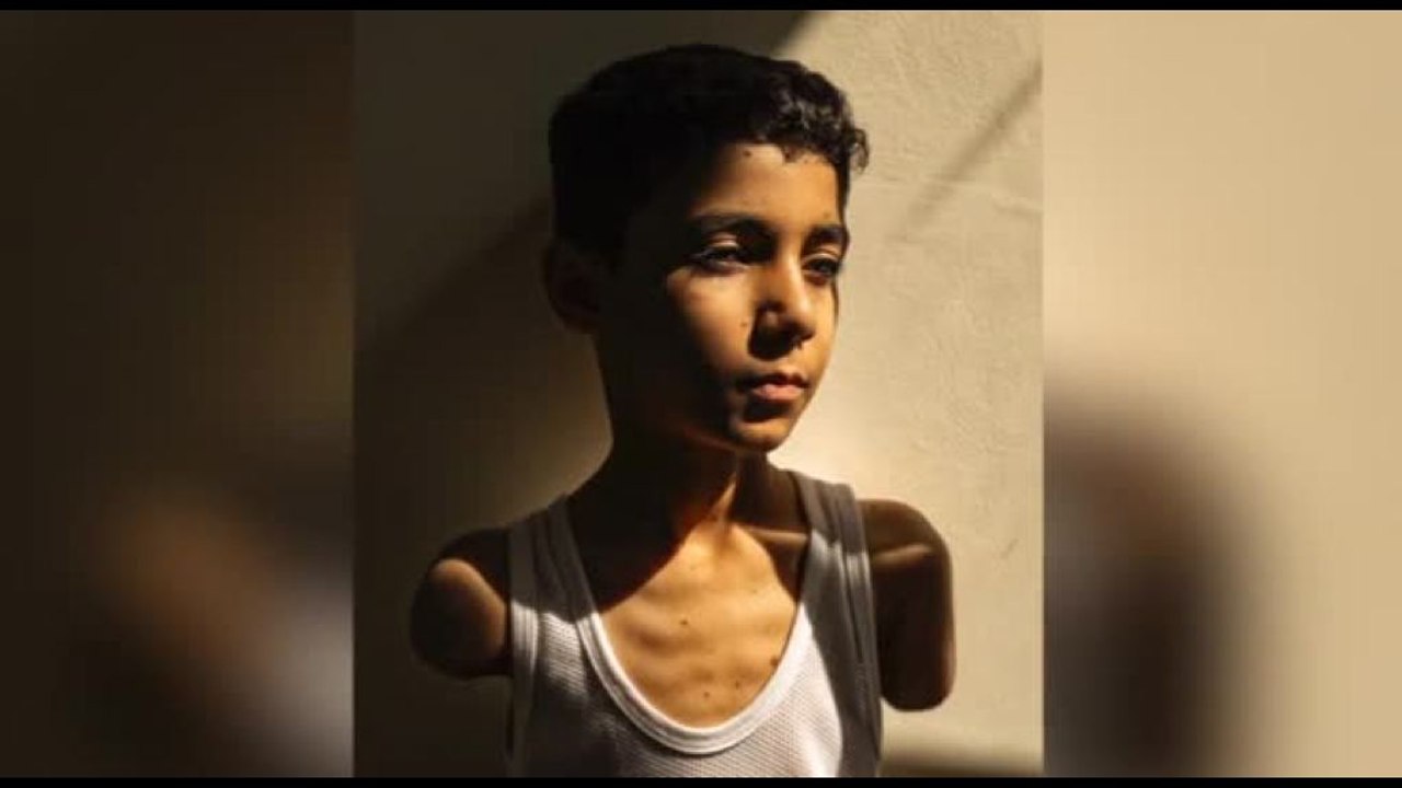 World Press Photo, un bambino mutilato a Gaza è la foto dell'anno
