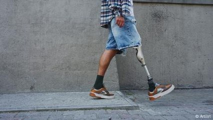 Günstigere Prothesen dank 3D-Druck