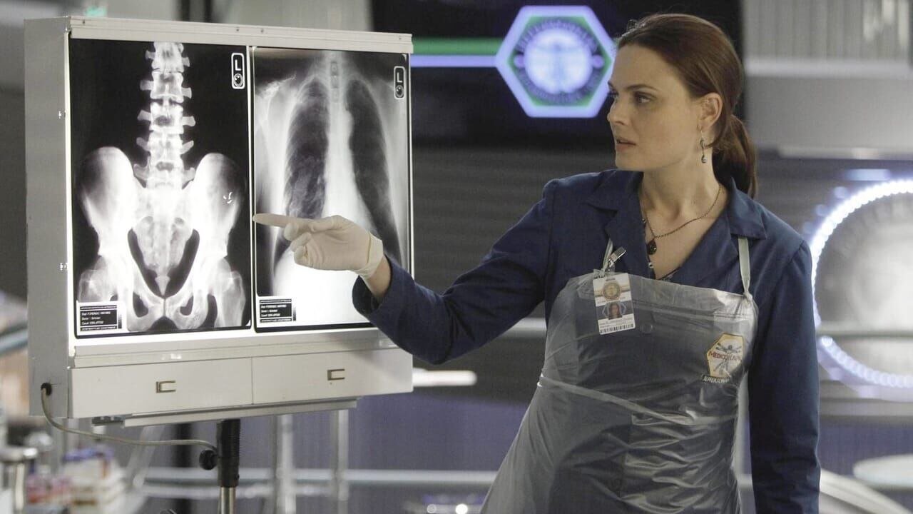 Bones