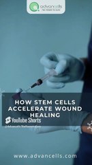 How stem cells accelerate wound healing?