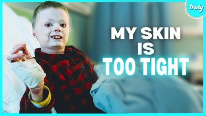 My Skin Is Too Tight For My Body | BORN DIFFERENT