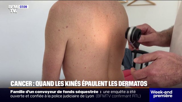 Cancer: quand les kinés épaulent les dermatos